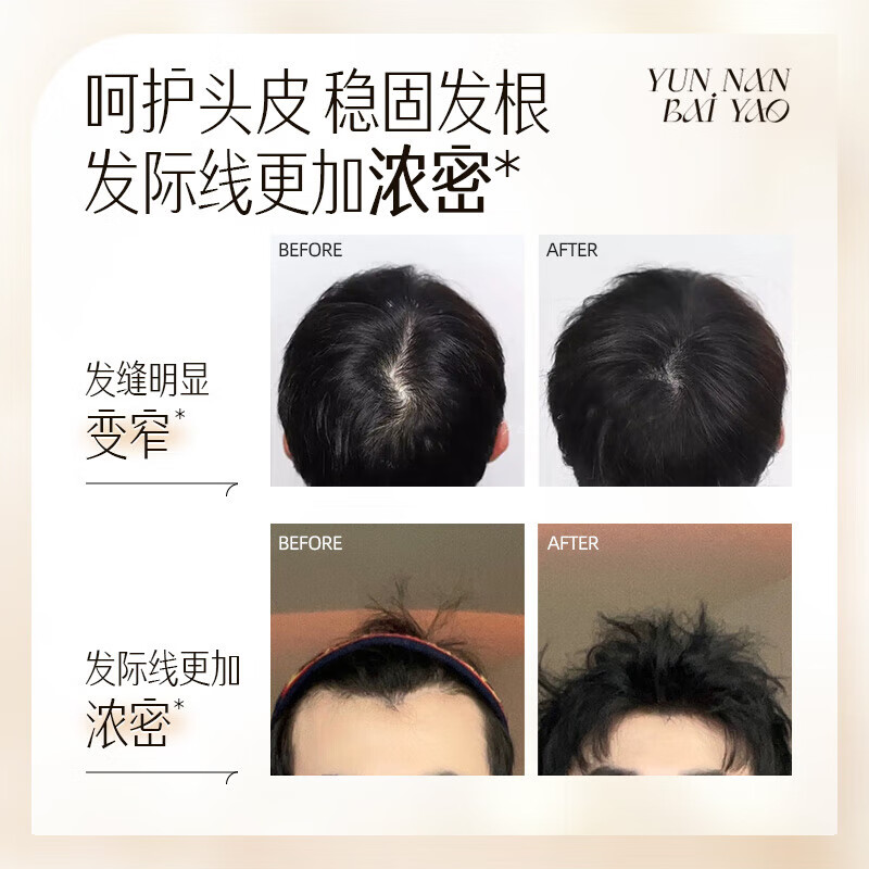 养元青洗发水防脱育发洗发水控油蓬松育发液护发固发洗头膏露套 【国妆特证】短发防脱洗发套装*3