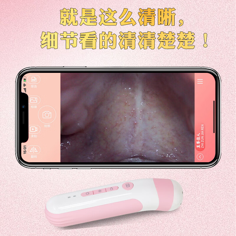 私密内窥镜电子镜高清宫颈检测仪妇科自检镜私密检查仪美容院 妇科超清检测镜+10.1寸平板电脑 (2个扩张器)