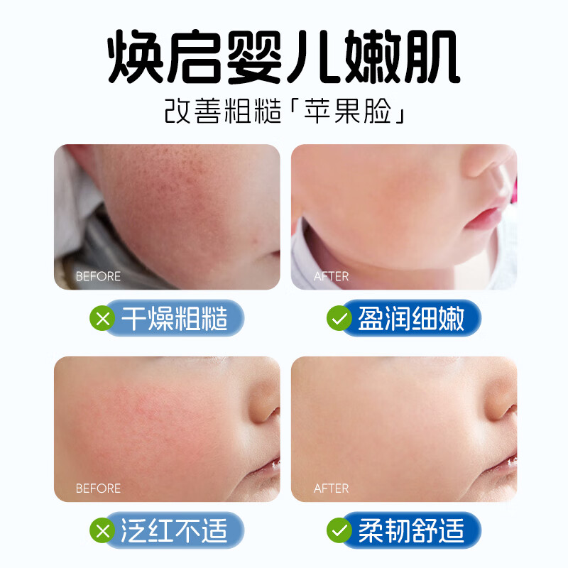 韩伦美羽 维生素原B5儿童面霜婴儿宝宝四季滋润舒缓保湿大白罐润肤身体乳 维生素原B5舒润婴童保湿霜100g*3瓶