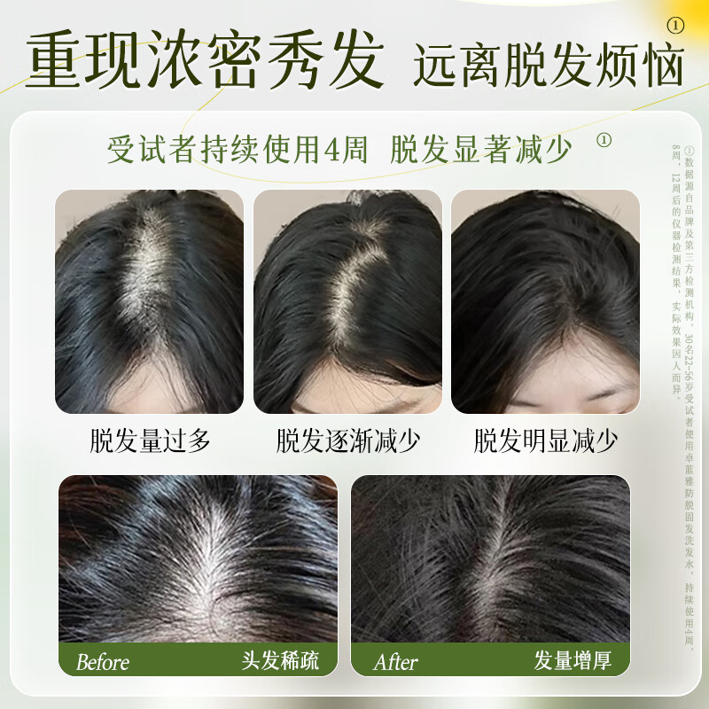 卓蓝雅(ZOOLY)洗发水800ml/400ml/800ml*2生姜防脱控油洗发护发套装 【洗护双效】防脱修护套装800ml*2(女士推荐)
