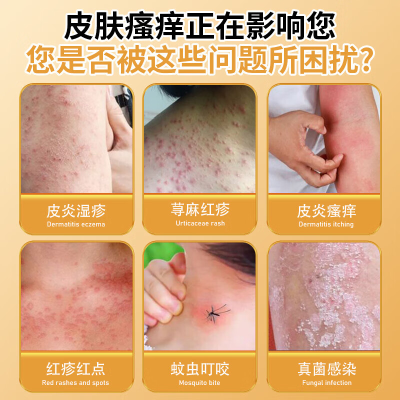 香港敬沛堂炉甘石香皂抑菌止痒皂除去螨虫全身痒皮肤干燥瘙外痒用全身皂 2盒【轻度止痒】