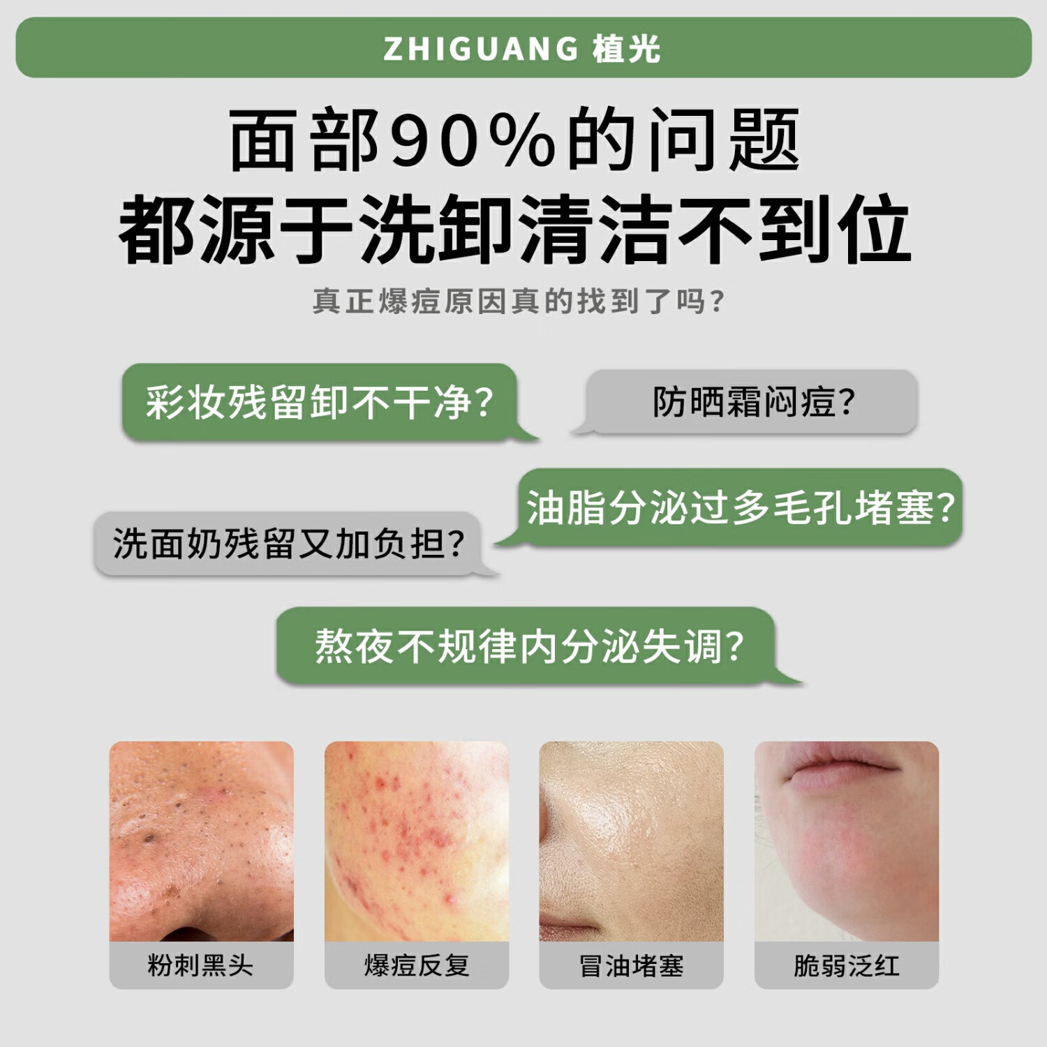 植光祛痘清爽洁面乳控油祛痘洗面奶深层清洁卸妆男女油痘肌不紧绷 200g 双瓶装