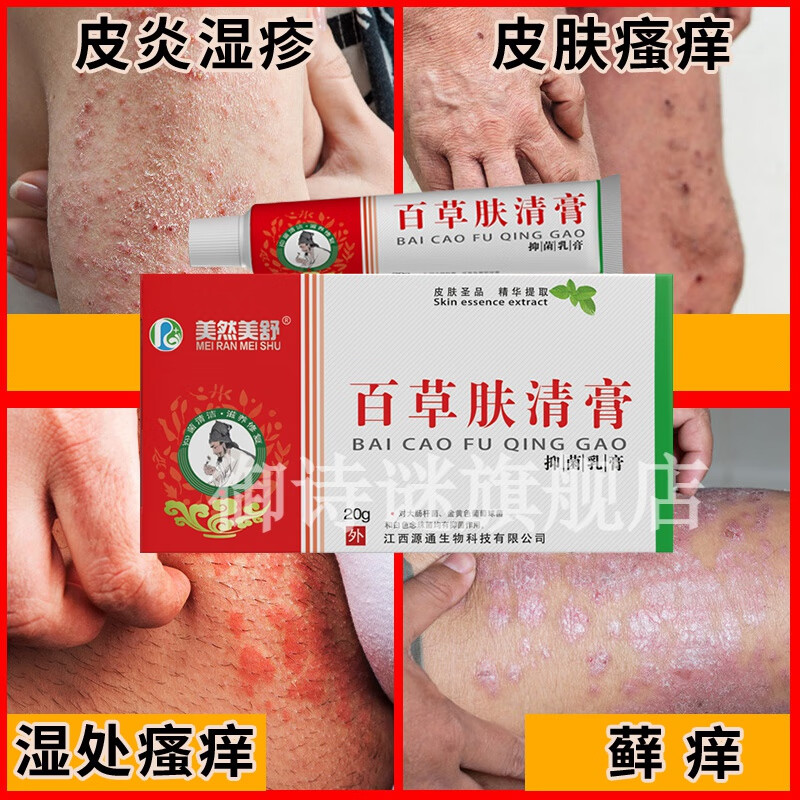 蛇蜕抑菌凝胶皮肤外用草本抑菌软膏季德胜癣克止痒草本手足起泡止 一