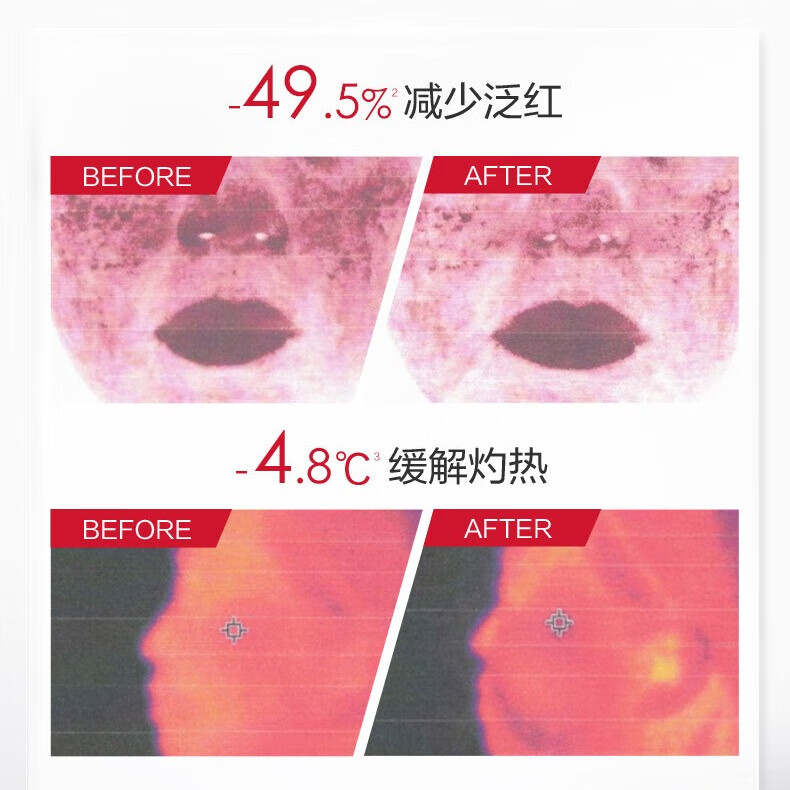 薇诺娜(WINONA)特护面膜 舒敏保湿补水舒缓敏感肌可用男女士礼物 项目后修护套组