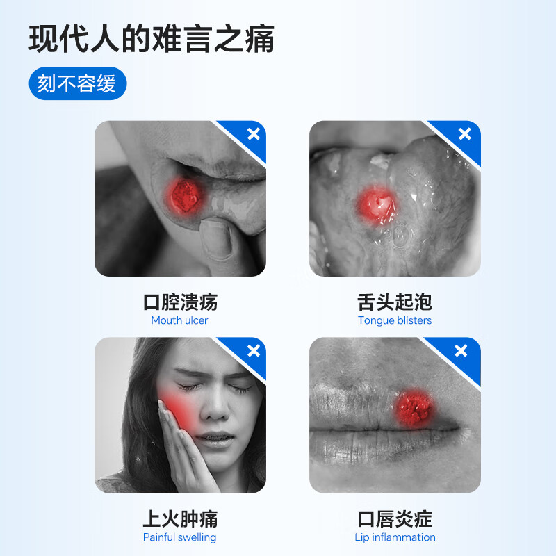 复因医用口腔溃疡含漱液缓解口腔炎症疼痛二类医疗器械 15ml*10袋/盒
