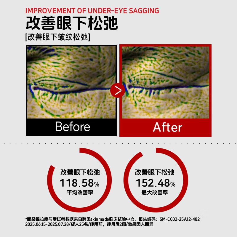 梦若羽（MRYU）MRYU高级消袋苷乳霜BEAUTYDRAMA医研眼部紧致霜微针眼霜补水保湿 1盒装【基础美白】 官方授权