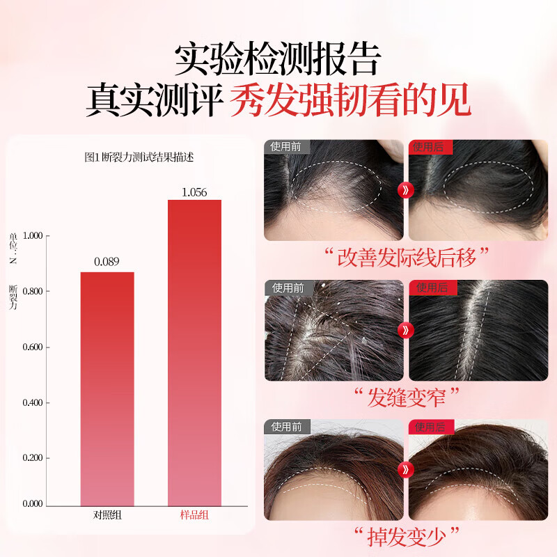 霸王女士防脱洗发水侧柏叶首乌护发套装留香洗发露洗头膏防掉发乳液 女士防脱400ml+女士香氛菁纯润发乳500g