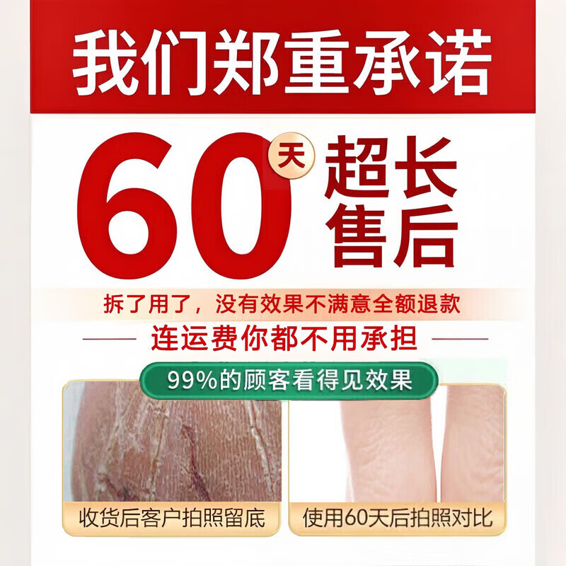 脚裂膏脚后跟干裂开裂干燥脱皮真菌去老茧蛇油皲裂膏手足润肤霜 1瓶试用装【一抹愈合开裂】 一抹愈合干裂去死皮滋润手脚保湿
