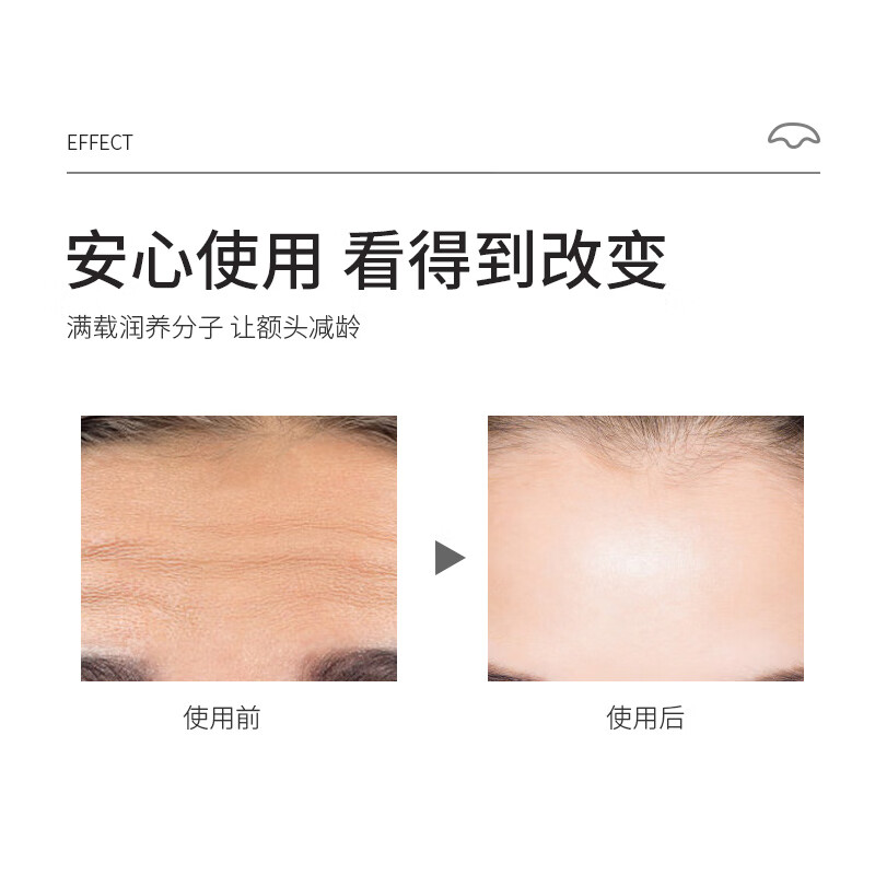 韩伦美羽凝水微晶额头贴额头皱纹眉心法令纹提拉额贴眉间贴川字纹抬头纹贴 10片 x2盒（水晶贴）额头纹/细纹/法令纹适用