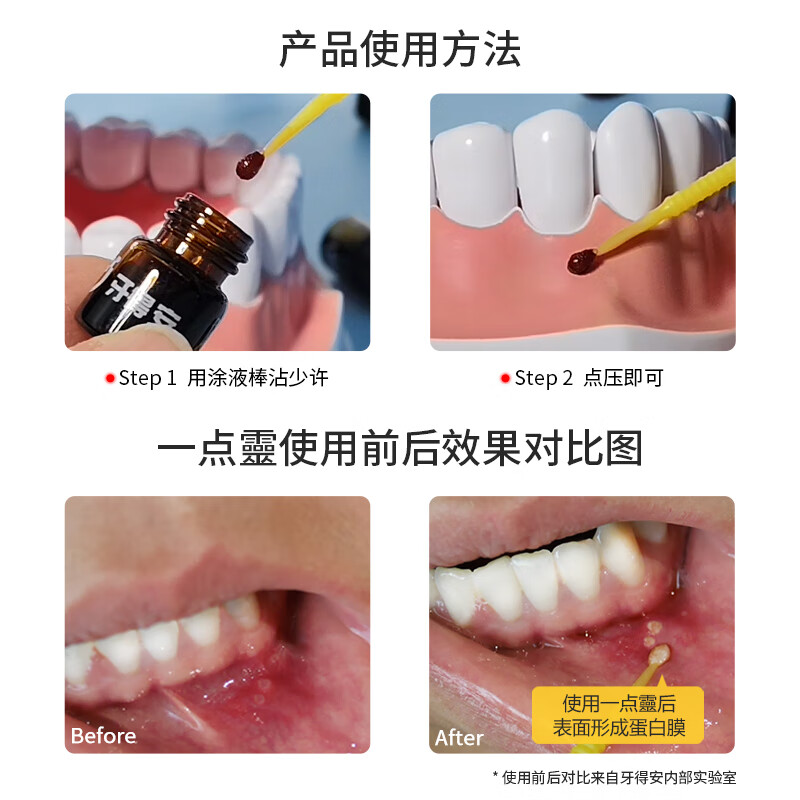 牙得安一点灵正品上火口腔不适口腔黏膜凉茶铺起泡送涂抹棒100支+牙粉 1.5m防伪一点灵+涂抹棒+牙粉五小包