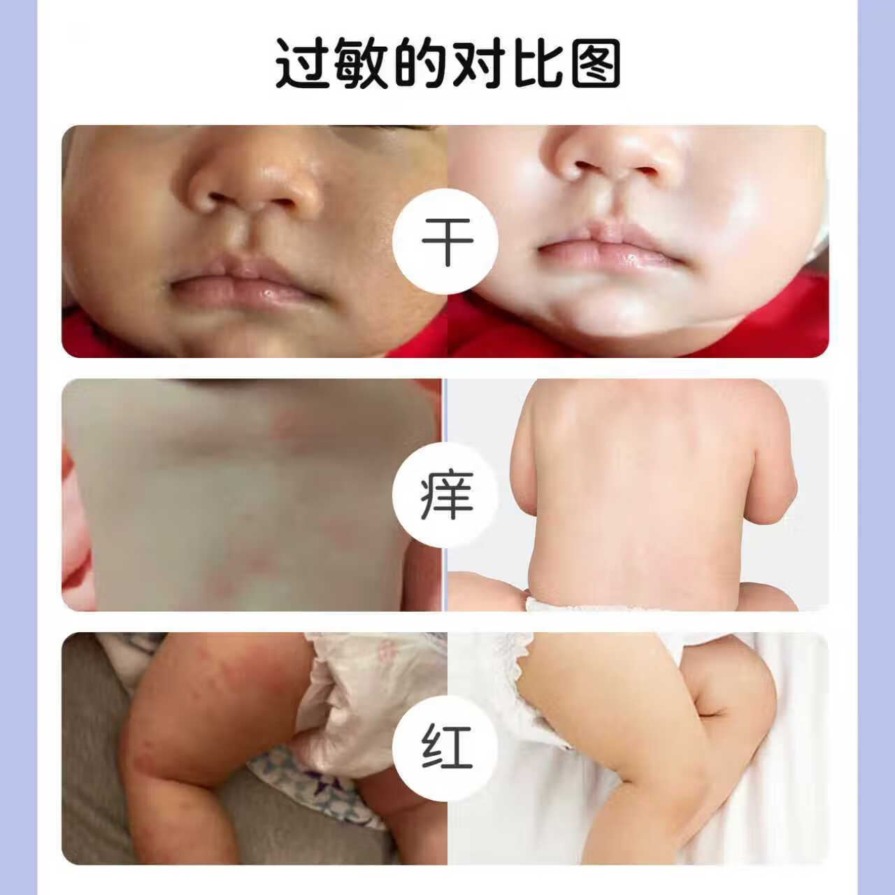 水萌宝儿童面霜春夏通用宝宝霜四维舒缓霜0-12岁补水保湿水润肌肤舒缓 滋润舒护50g*1