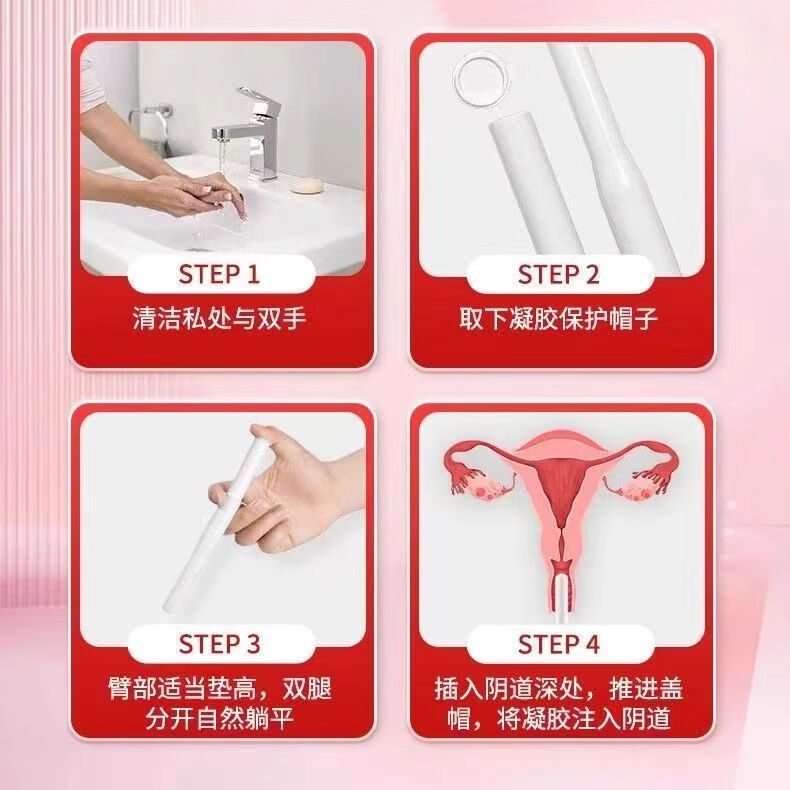 修正妇科医用抗HPV凝胶敷料4支/盒瘙痒白带异味阴道炎宫颈炎保密发货 3盒【医用抗HPV凝胶敷料】