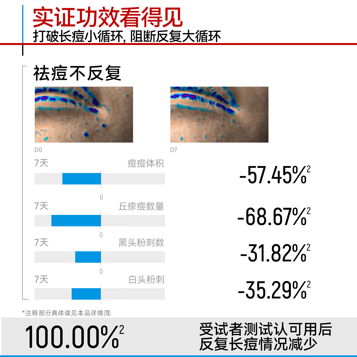 芙清温和祛痘精华液舒缓清痘淡化痘印保湿控油修护改善泛红520礼物 祛痘精华50ml*2【大规格囤货100ml】
