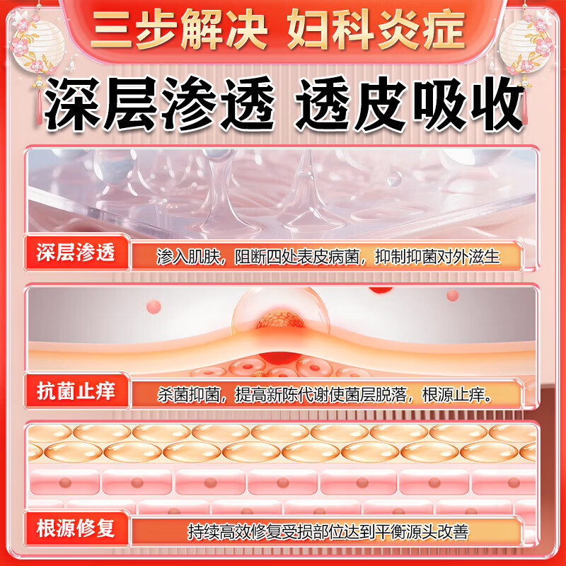 [中大]克霉唑栓 0.15g*10枚 2盒装 妇科炎症霉菌性阴道炎宫颈糜烂专用药甲硝唑外阴瘙痒白带豆腐渣阴道塞药杀菌消炎药 阴道炎 妇科炎症大