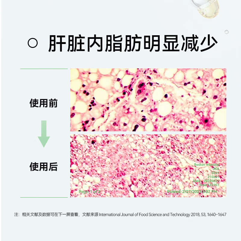 LAIFE乐轻肝护肝片官方店净肝胶囊清肝排毒解酒脂肪肝胆固醇转氨酶  2盒装【保持肝脏年轻态】
