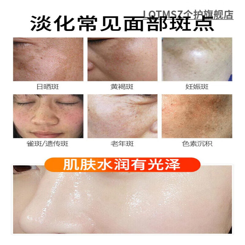 LQTMSZ新活消斑霜珍维丝溶斑膏美白精华液祛斑霜黑色素淡斑
2瓶 浓缩型排黑膏【适合中度斑点】