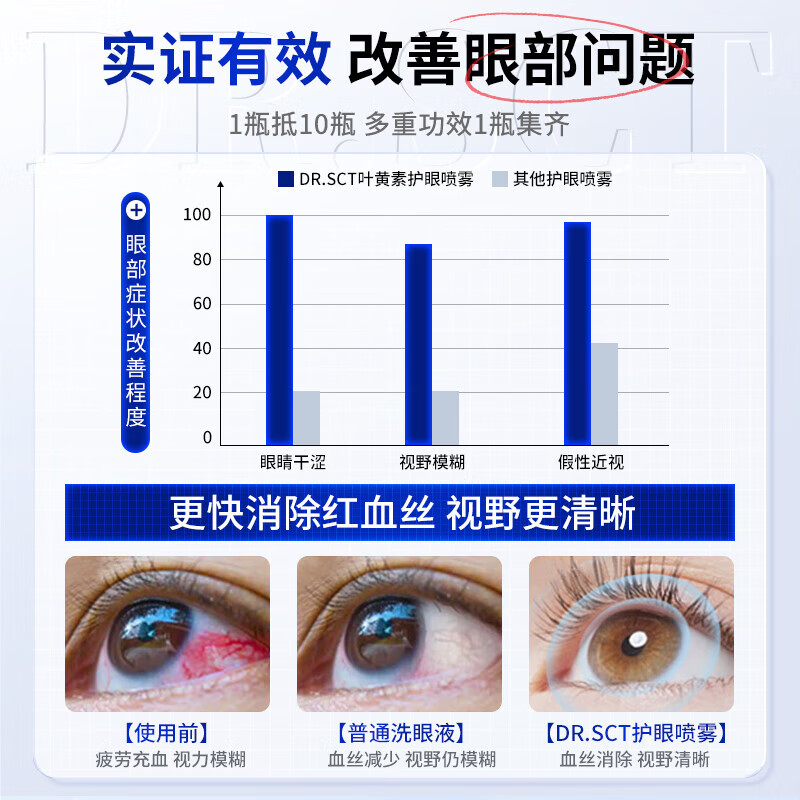 DR.SCT叶黄素滴眼液缓解眼疲劳眼干眼涩视力模糊发痒红血丝眼药水 【明目润眼】叶黄素护眼喷雾*5