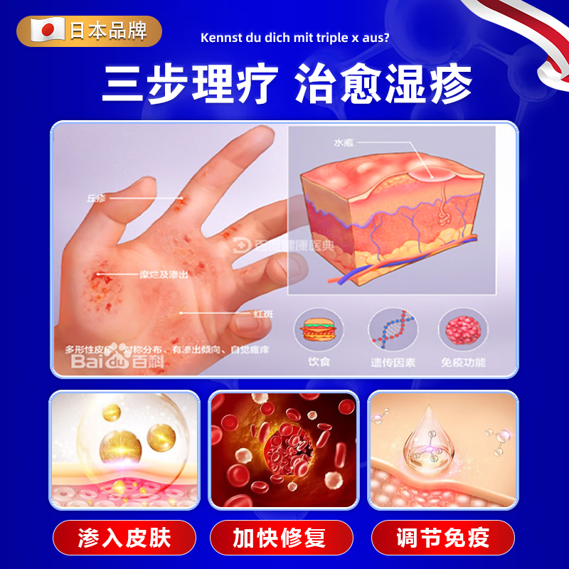 北京协和医学院湿疹药膏十大牌子皮肤瘙痒皮炎湿疹真菌感染止痒苗药日本原装进口 3盒【专攻各种湿疹包痊愈柏可芬 诺瑞达湿疹冬季皮肤瘙痒止痒