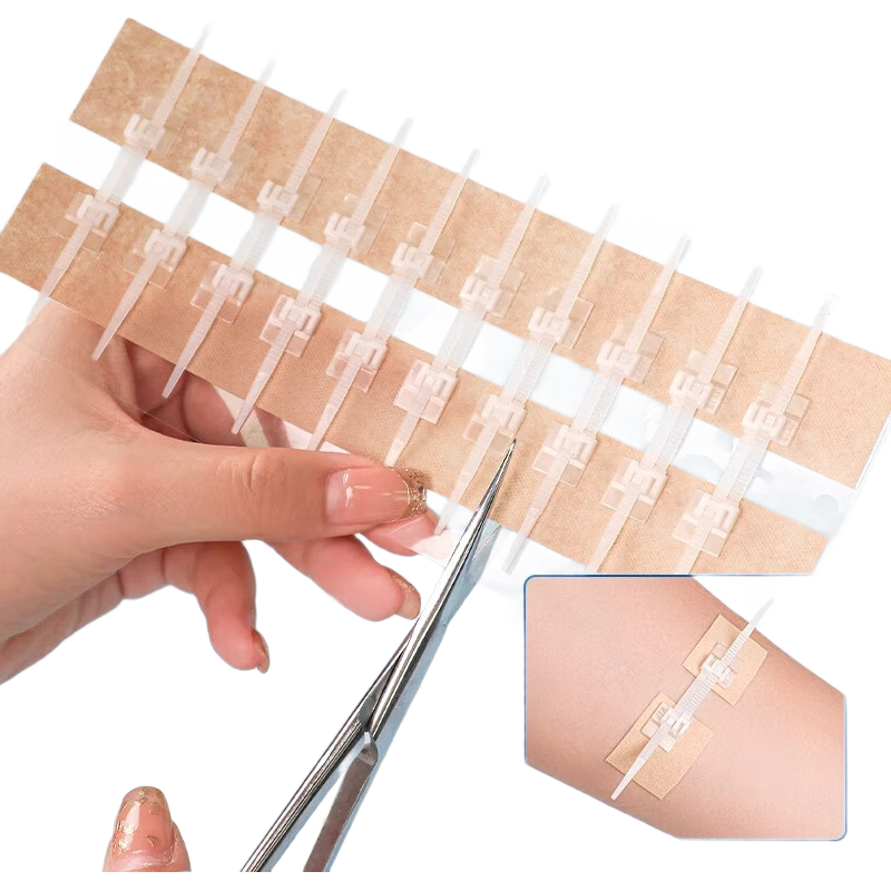 海氏海諾減張器減張貼醫用剖腹產(chǎn)術(shù)后皮膚疤痕兒童免縫合傷口貼 10扣 3盒共3片(送碘伏+棉簽)