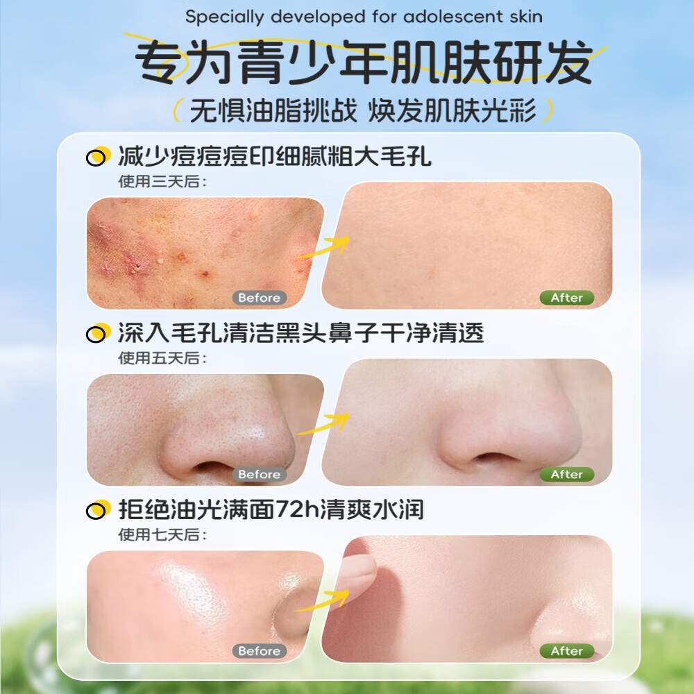 LILIA青少年氨基酸洁面乳12-18岁控油清痘洗面奶初高中生洁面深层清洁 300ml 【青少年必入】ko青春痘痘印黑头