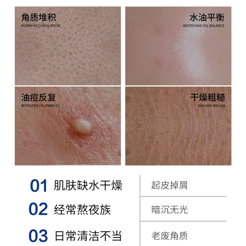 斯诺舟甘醇酸水搭喷雾滋润保湿敷爽肤水紧致清洁闭口粉刺毛孔温和不刺激 240ml1瓶体验装