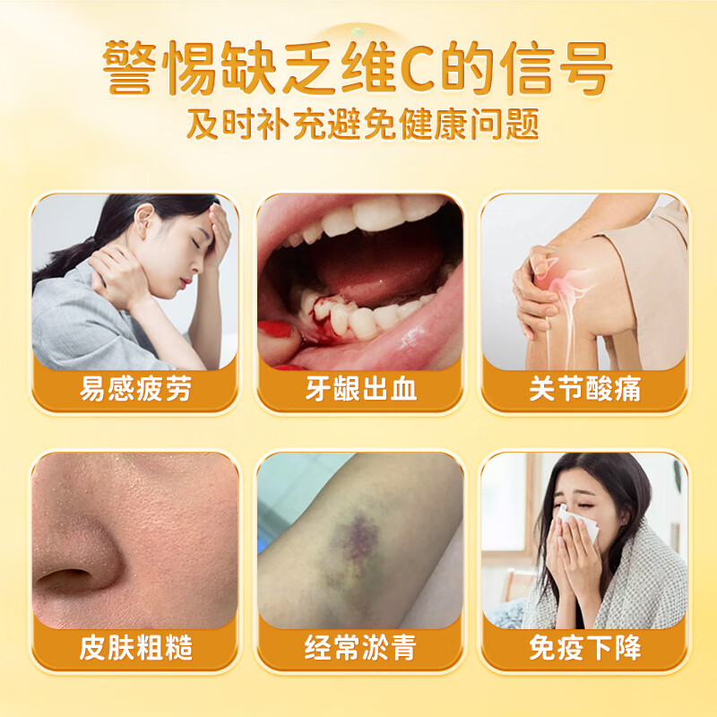 黄金搭档维生素c咀嚼片 维c vc片维生素c增强免疫力 自成人儿童营蓝帽认证 【体验装】 70片*1瓶