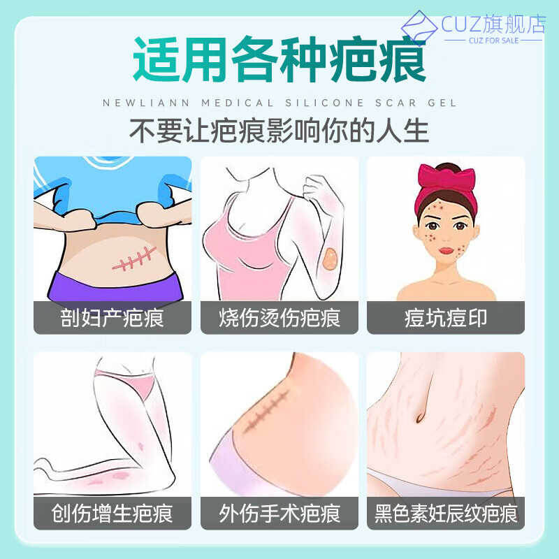 熏姿颜hue硅酮敷料祛i疤膏除i疤痕增生凸起去除疙瘩修复手术剖腹产医用 一盒【体验装】 官方直售
