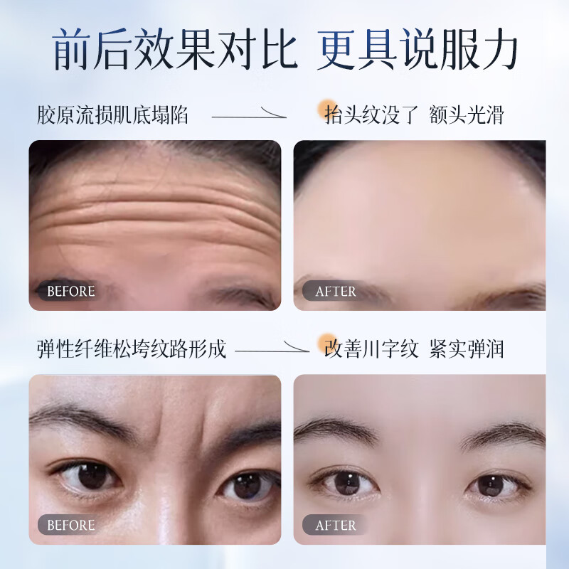 碧素堂抬头纹去除男额头眉间川字纹贴法令纹消除神器提拉紧致皱纹女专用 20片【基础装】轻度适用【4盒】