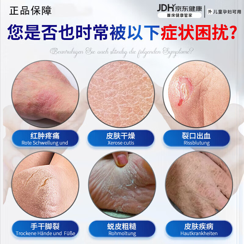 脚裂膏脚后跟干裂开裂干燥脱皮真菌去老茧蛇油皲裂膏手足润肤霜 1瓶试用装【一抹愈合开裂】 一抹愈合干裂去死皮滋润手脚保湿