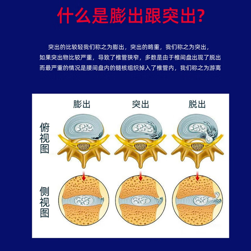 九蜗曲度变直矫正器颈椎牵引器医用反弓矫正器家用按摩器康复专用治理疗仪 使用指导电子说明书 中频脉冲+艾灸热敷+牵引