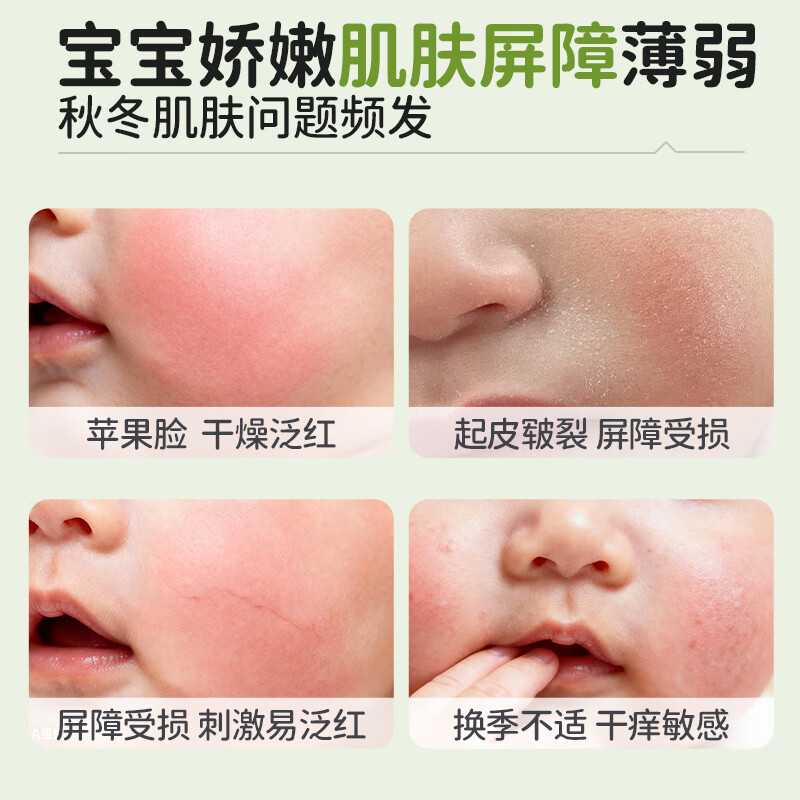 KoalaMan考拉侠澳洲进口金盏花面霜50g婴儿宝宝霜滋润保湿舒缓修护苹果脸 【热卖爆品】金盏花保湿霜50g/瓶