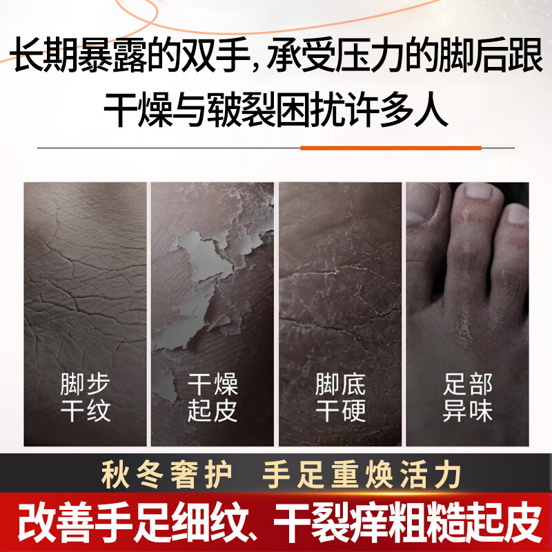 Baby Foot滋润保湿嫩肤脚霜脚膜脚后跟干裂修复霜嫩白脚步护理足霜1支