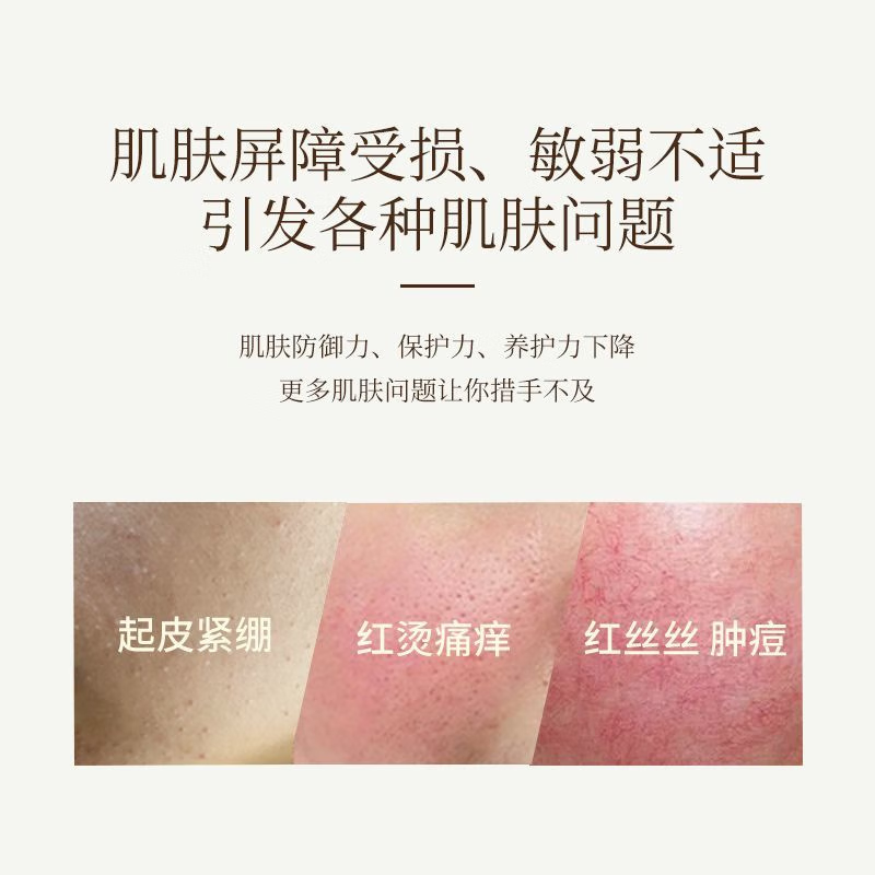 果木果然植萃清肌水润乳保湿控油祛痘滋润肌肤补水保湿嫩滑肌肤 祛痘系列130ml植萃清肌水润乳