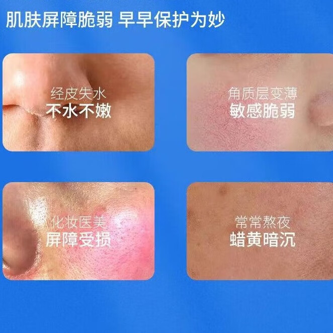 修正修护面霜【敏痘】干燥换季敏感泛红保湿滋润面霜角质层舒缓修护霜 3瓶【角质层舒缓修护霜】 50g/瓶