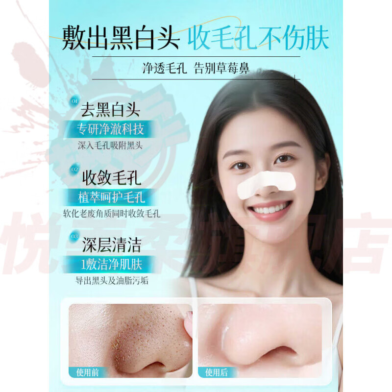 喜姿盈jsv黑头导出液精华液水美容院专用去收缩毛孔粉刺妙鼻贴官方正品 1瓶【体验装】