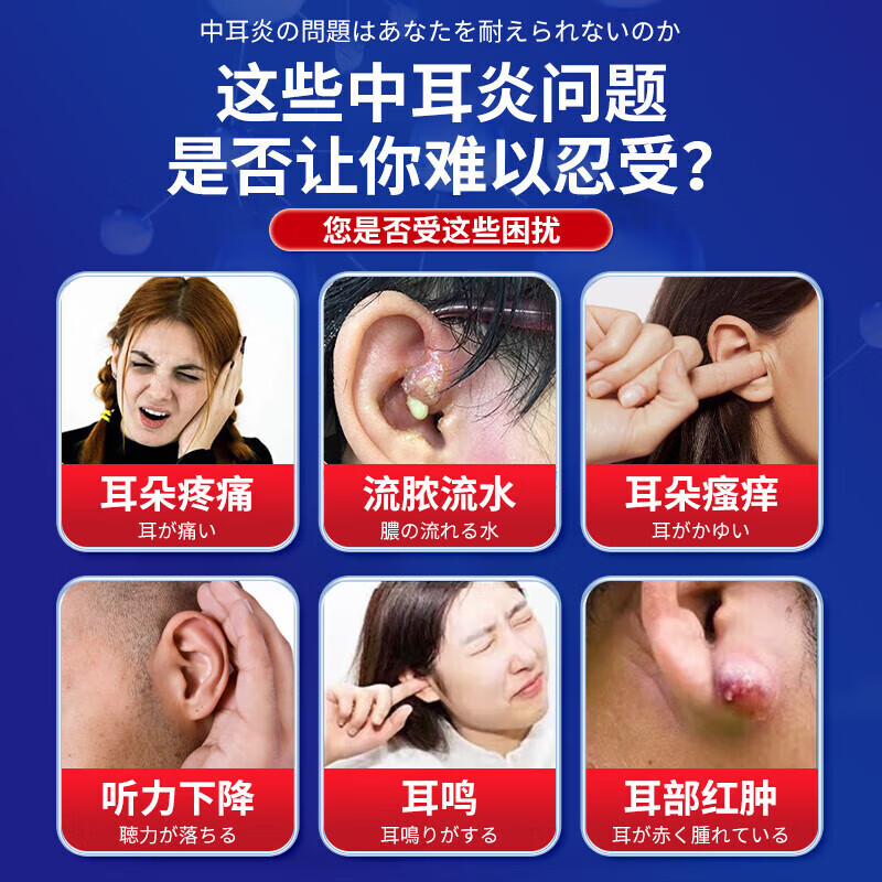岩井昃弘制药日本进口中耳炎滴耳液专用的药治疗耳道发炎流脓水止痒抑菌儿童用 1盒装【进口特效】