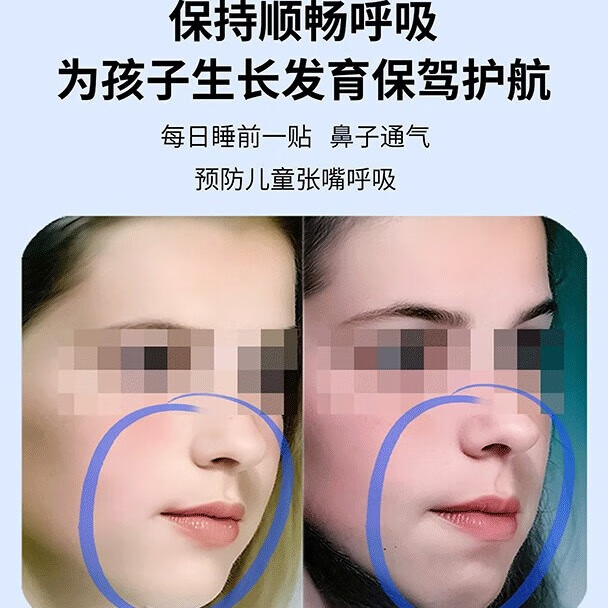 带趣一贴通鼻炎贴舒贴人儿童鼻塞宝宝缓解畅通痒炎男女老少官方旗舰店 【鼻炎贴】5盒*35贴