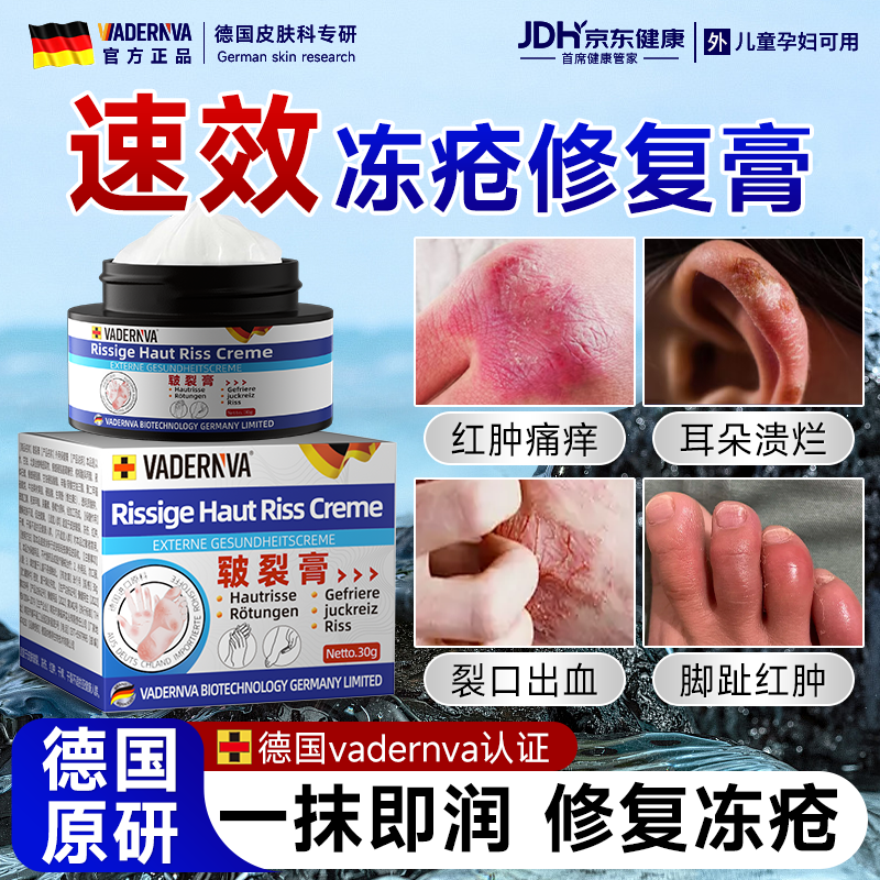 VADERNVA德国冻疮膏耳朵手足成人脸止痒冻伤膏消痛儿童男女士冻伤膏特效 三盒装【中重度】冻疮感染红肿出血