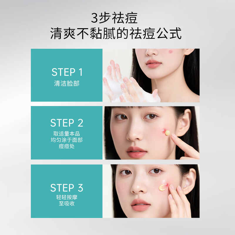 愛心梦缘第五代祛痘啫喱无酸胶态硫温和祛痘粉刺保湿改善痘痘肌301