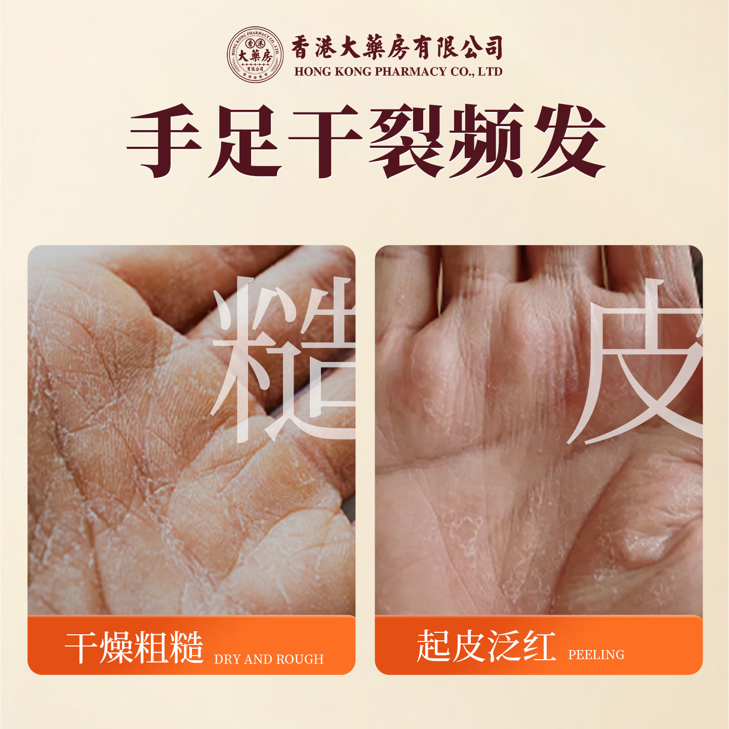 香港大药房马油防裂膏手足裂干裂护手霜脚裂脚后跟开裂手裂口严重足跟皲裂膏 1瓶【皮肤干裂】买2送1