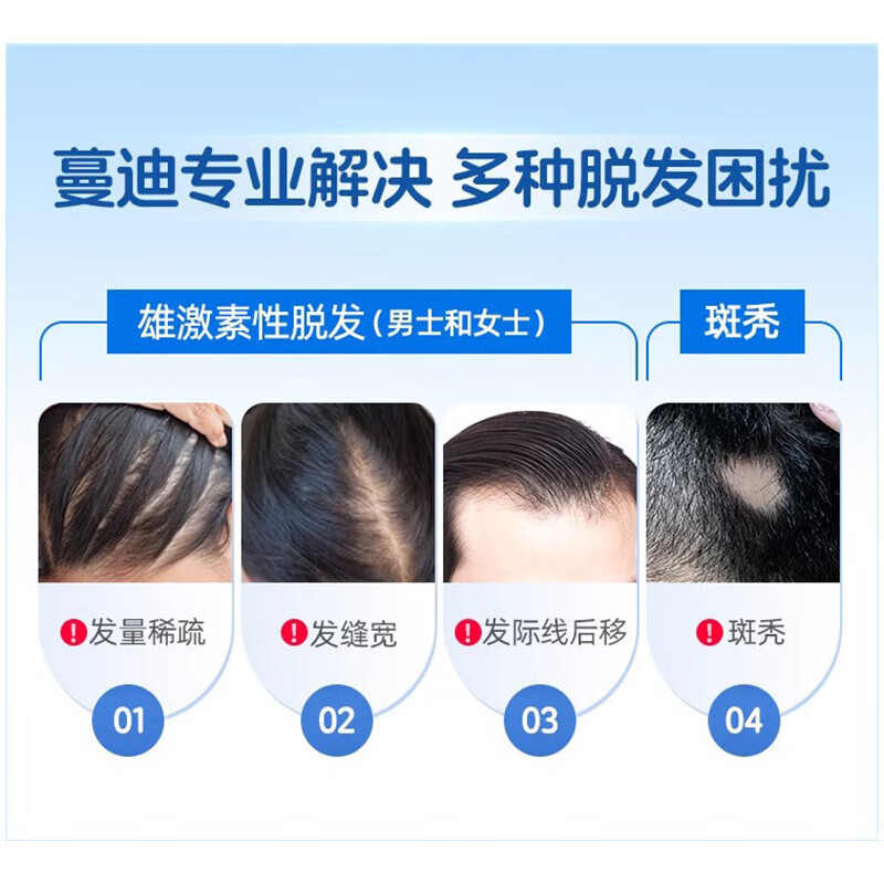 [蔓迪]米诺地尔酊 5%*90ml*2瓶 1盒装 5%浓度生发增发液喷雾生发液男女防脱发严重脱发秃发治疗脱发斑秃防脱生发 咨询客服领大额券