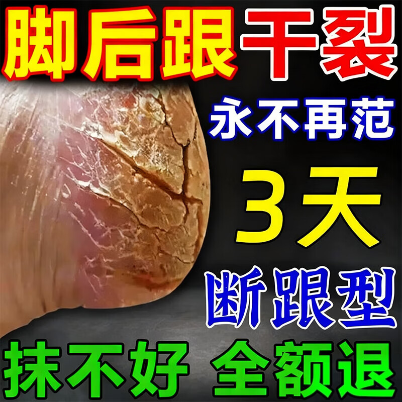 脚裂膏脚后跟干裂开裂干燥脱皮真菌去老茧蛇油皲裂膏手足润肤霜 1瓶试用装【一抹愈合开裂】 一抹愈合干裂去死皮滋润手脚保湿