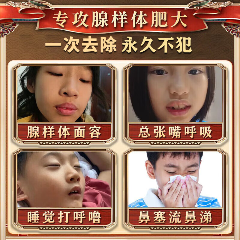 腺样体肥大中药贴儿童用药嘴突鼻塞张嘴呼吸睡觉打鼾面容矫正器 【升级版】买3送2【100%治好】