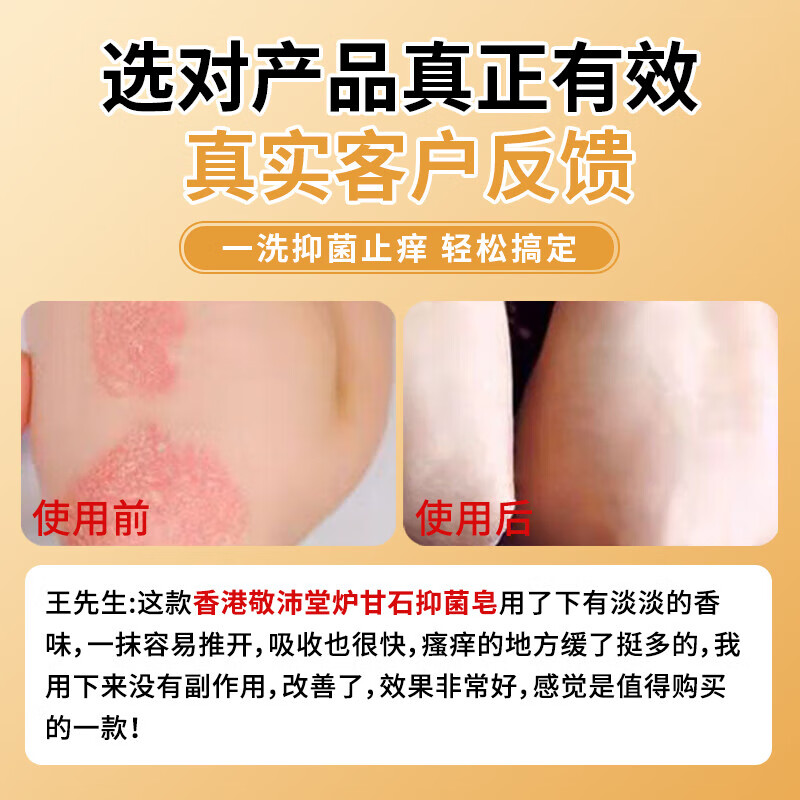 香港敬沛堂炉甘石香皂抑菌止痒皂除去螨虫全身痒皮肤干燥瘙外痒用全身皂 2盒【轻度止痒】