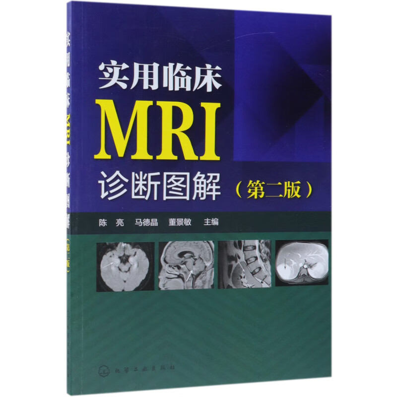 实用临床MRI诊断图解(第2版)