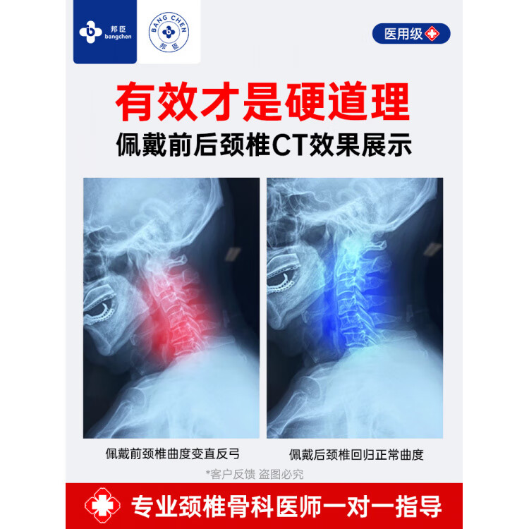 邦臣（BANGCHEN）医用颈椎牵引器颈托护颈家用拉伸脖子前倾医院专用理疗器 【医用级】颈椎固定牵引