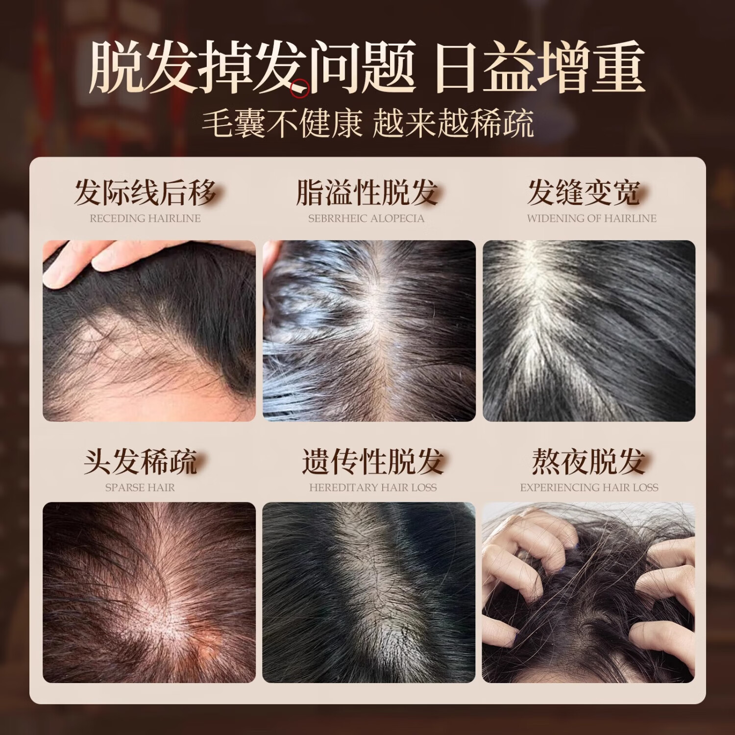 初蔓洗发水防脱育发固发养发育发增发密发男女士专用侧柏叶生姜洗发露 【持证防脱】侧柏叶防脱洗发水600ml 药房同款侧柏叶防脱洗发水TOP榜