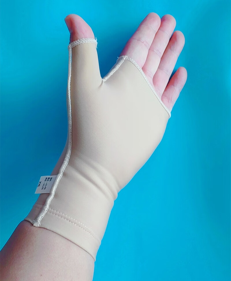 医用压力手套弹力套疤痕加压烧伤抗疤痕弹力手套儿童烫伤防增生瘢 1只