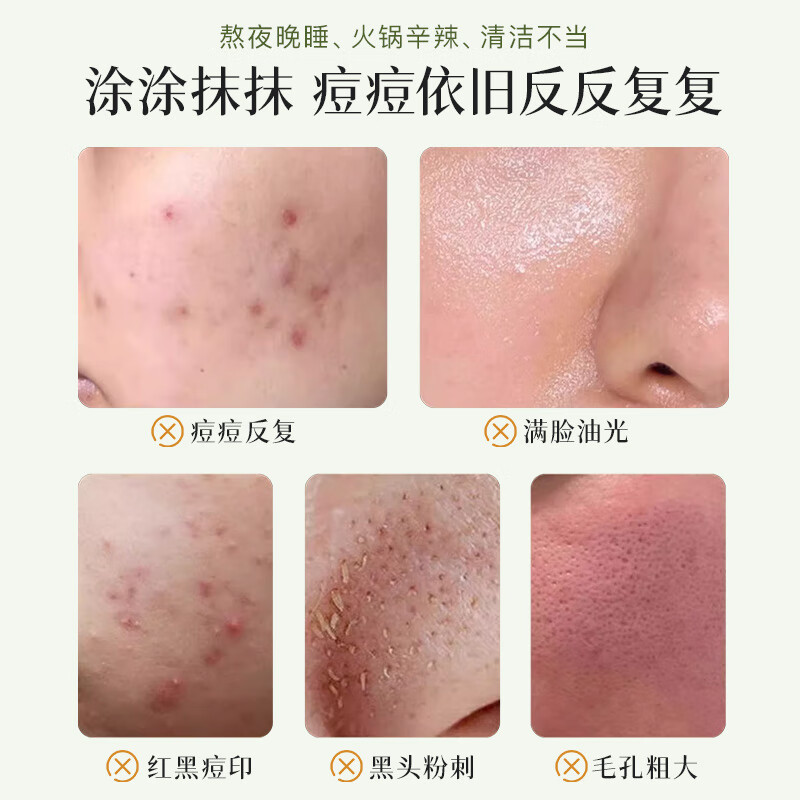 HKH水杨酸果酸祛痘清肌精华液细化毛孔熬夜保湿控油嫩肤净颜新年礼物 水杨酸果酸祛痘精华液50ml