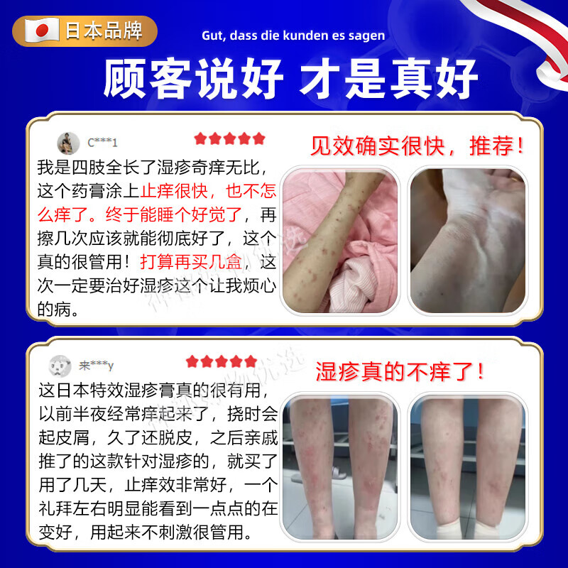北京协和医学院湿疹药膏十大牌子皮肤瘙痒皮炎湿疹真菌感染止痒苗药日本原装进口 3盒【专攻各种湿疹包痊愈柏可芬 诺瑞达湿疹冬季皮肤瘙痒止痒
